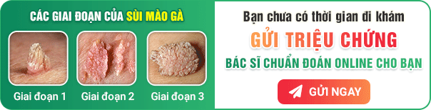 Shortcode triệu chứng bệnh sùi mào gà