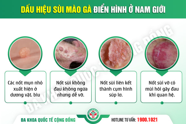 “Cậu nhỏ” bỗng dưng nổi mụn thịt: 99% đến từ bệnh lý nguy hiểm